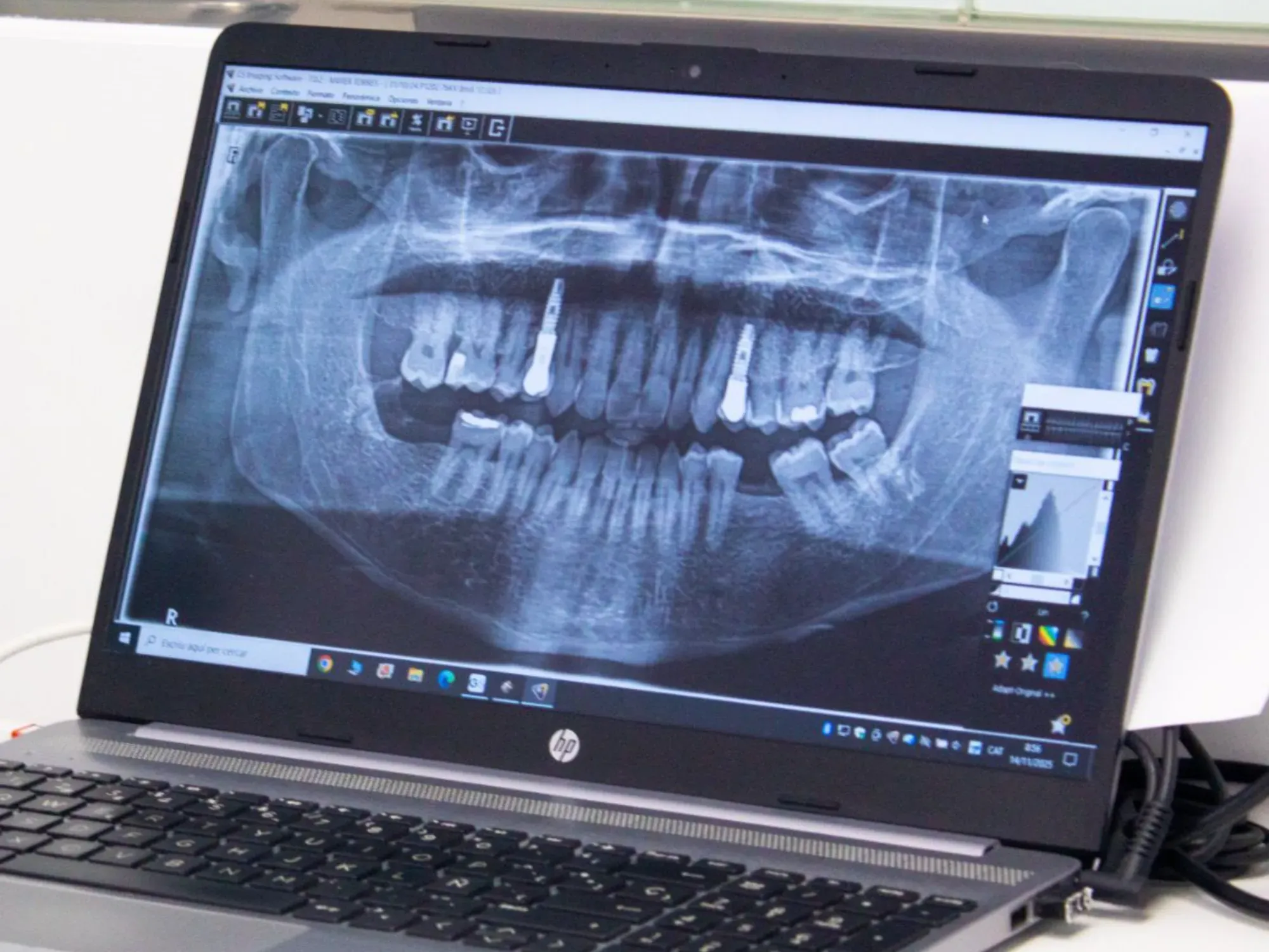 clinica-dental-sitges-dentista-confianza-2