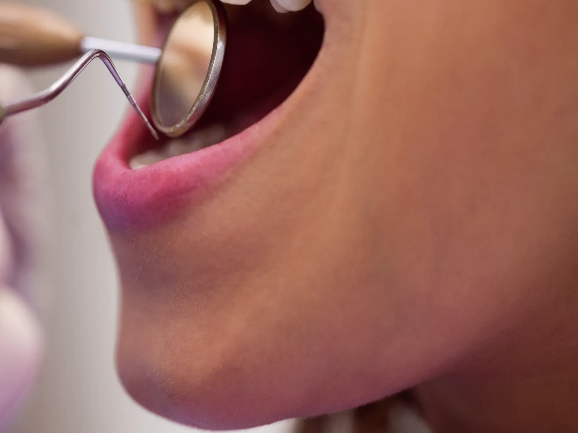 clinica-dental-sitges-dentista-manresa-0