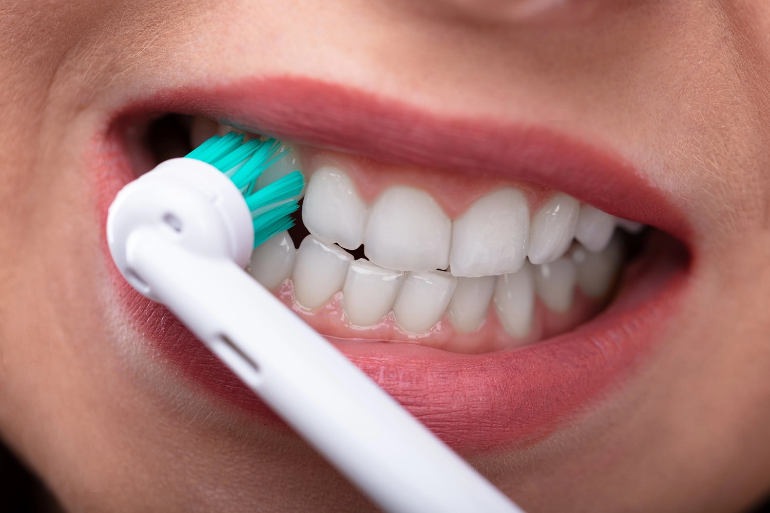 Clinica Dental Sitges Apnea 5