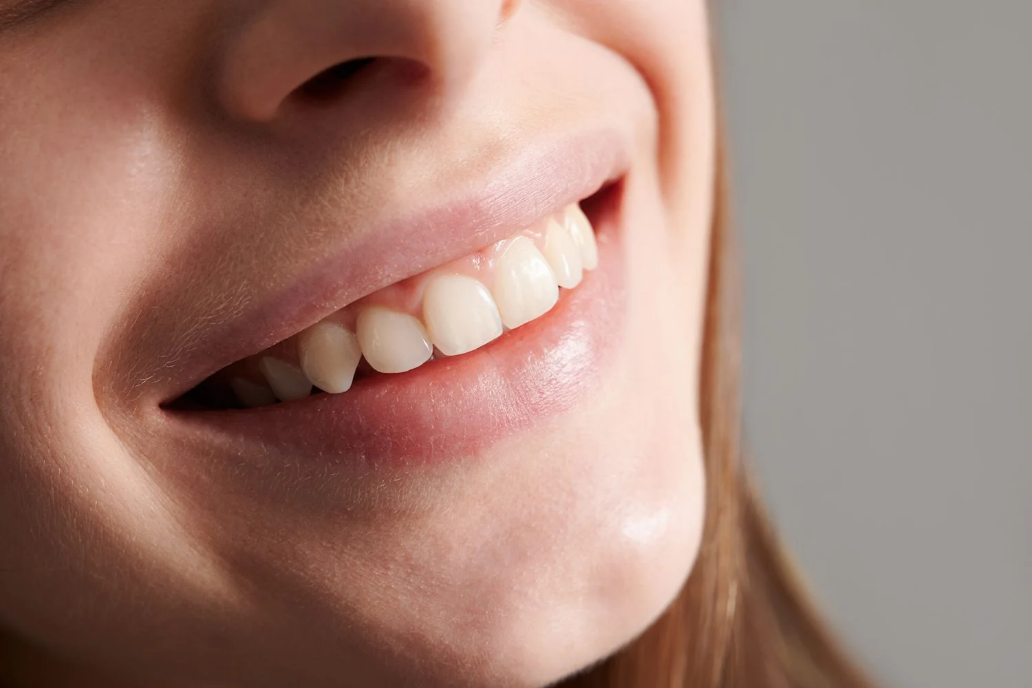 Dientes Mas Blancos 1 Dientes Mas Blancos 1