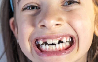 Clinica Dental Sitges Dents Tortes 5