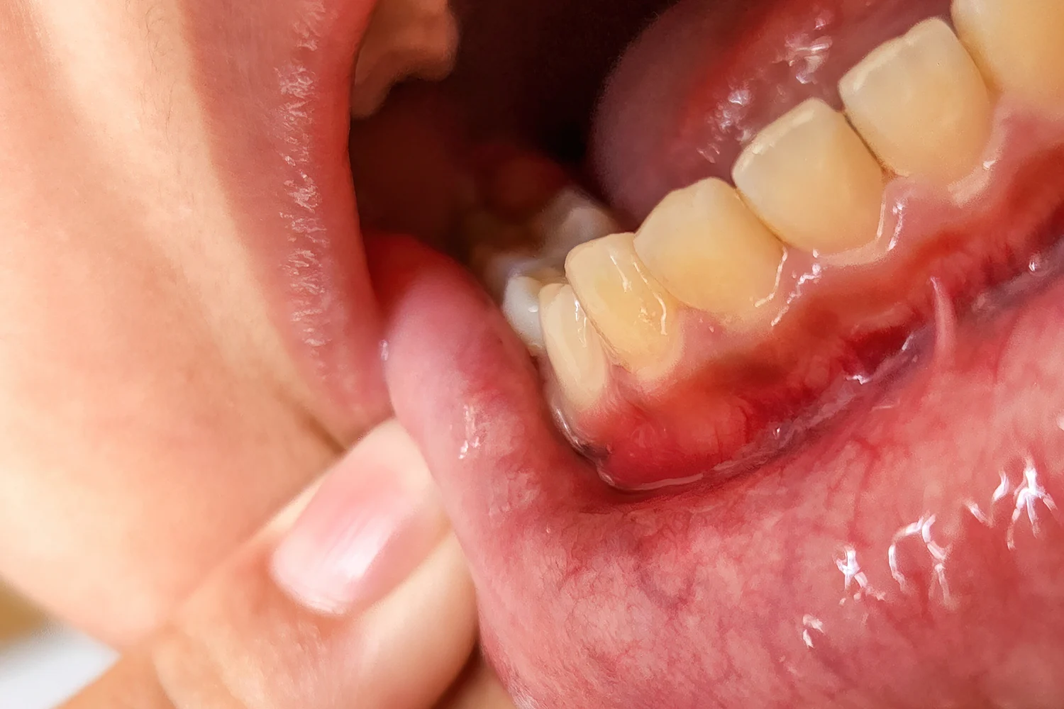 Clinica Dental Sitges Ganives 0 Clinica Dental Sitges Ganives 0