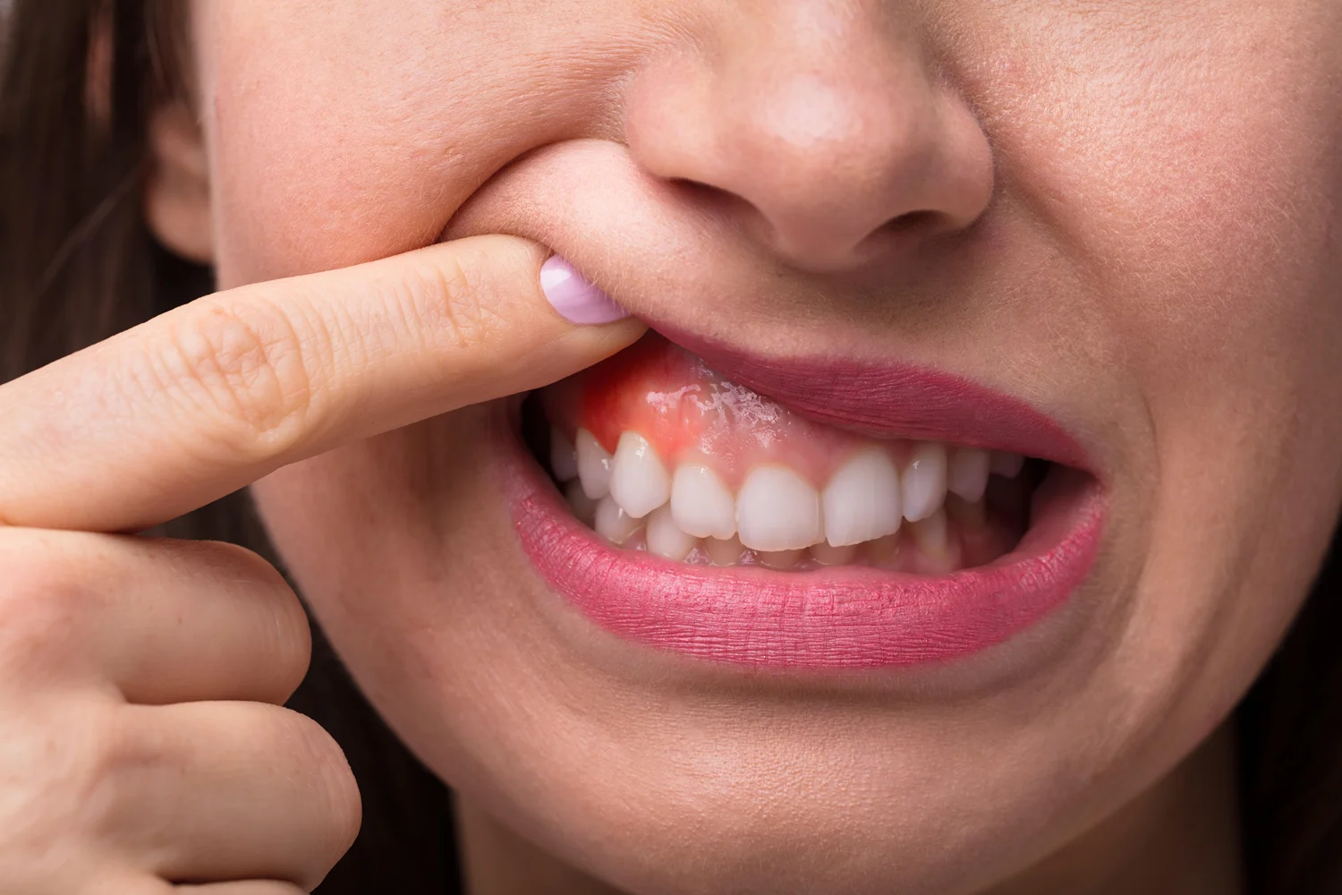 Clinica Dental Sitges Ganives 4 Clinica Dental Sitges Ganives 4