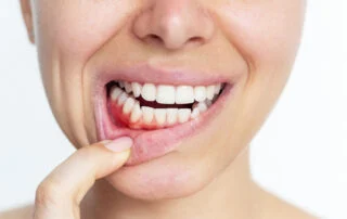 Me sangran las encías: ¿es normal o debería preocuparme? 2 Clinica Dental Sitges Ganives 7