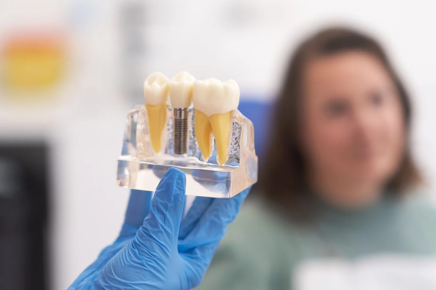 Clinica Dental Sitges Implantes Dentales 2 1 Clinica Dental Sitges Implantes Dentales 2 1