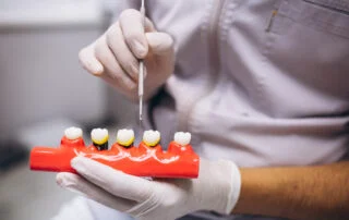 Clinica Dental Sitges Implantes Dentales 3 1